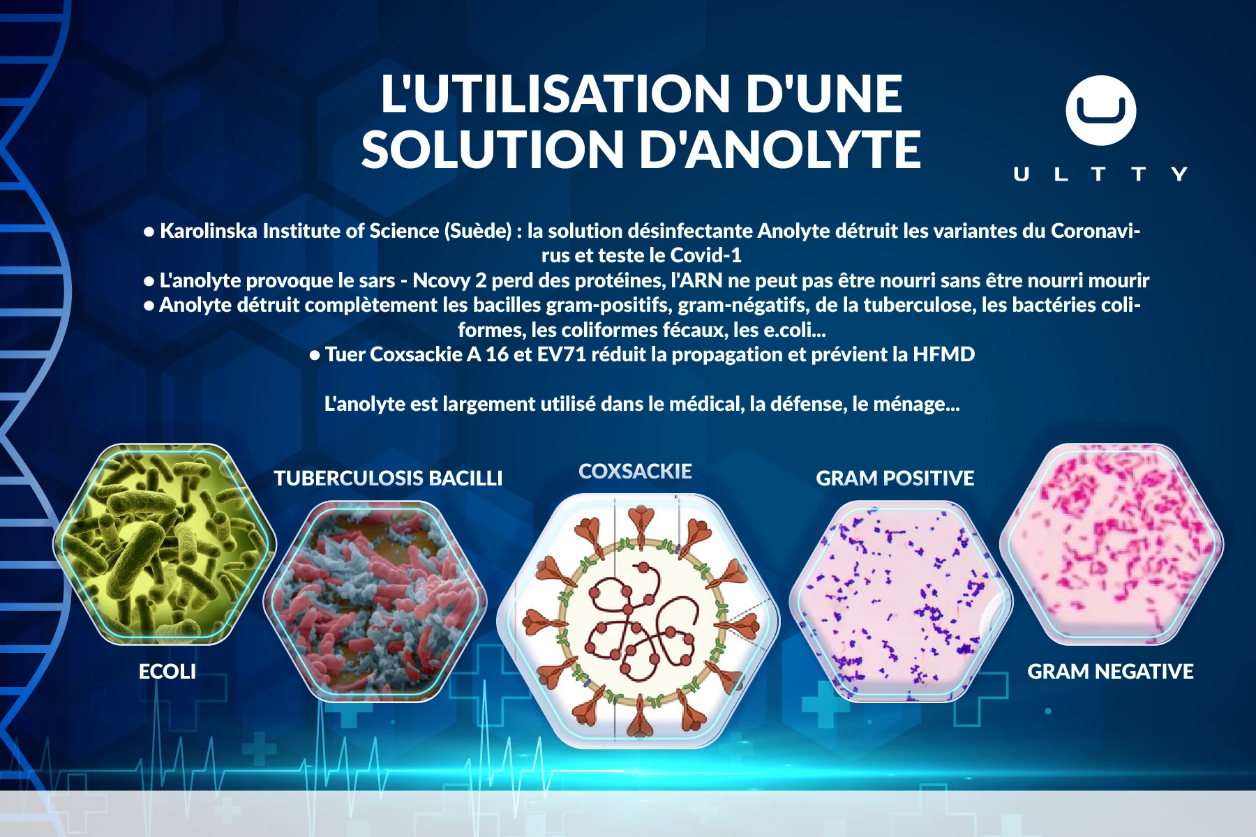 cong-_dung-_binh-_dien-_phan-_french-02.png-large